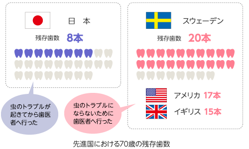 先進国における70歳の残存歯数（スウェーデン20本、アメリカ17本、イギリス15本に対して、日本は8本）